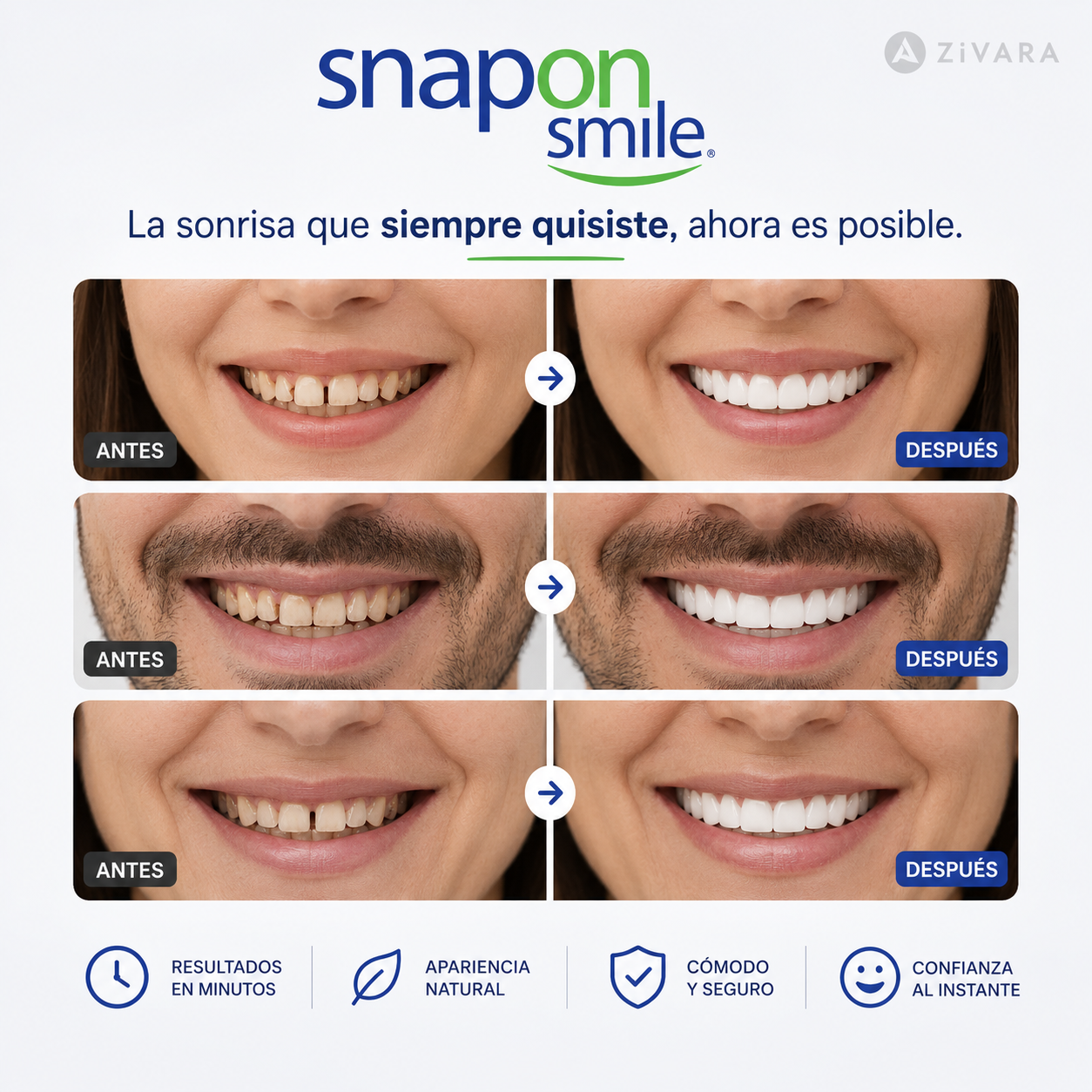 🦷 Carillas dentales SnapOn Smile 😁✨